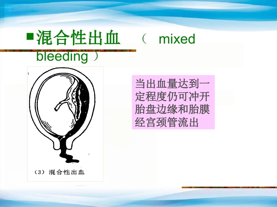 异常产褥妇产科学3_第11页