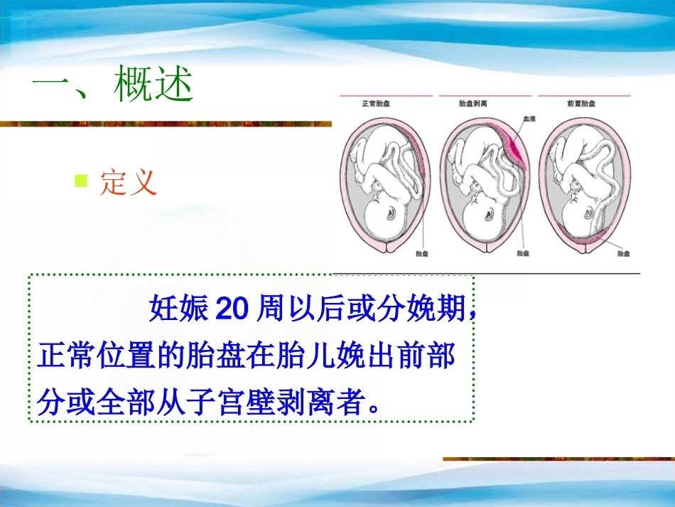异常产褥妇产科学3_第2页