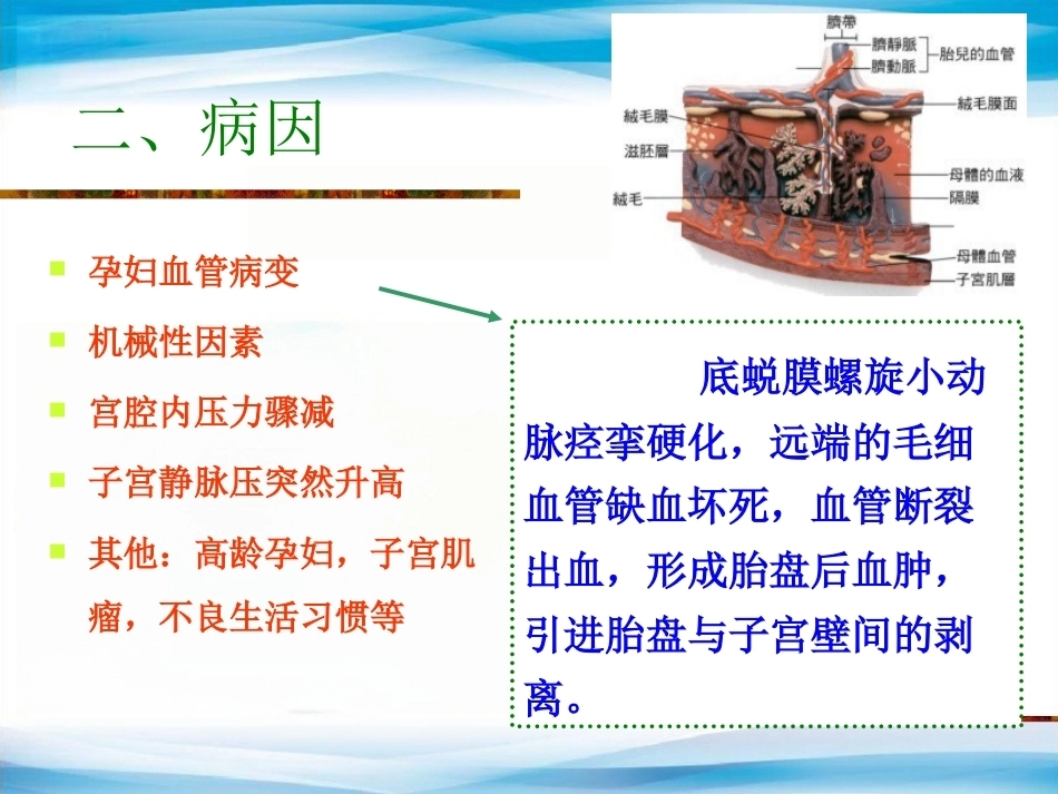 异常产褥妇产科学3_第4页