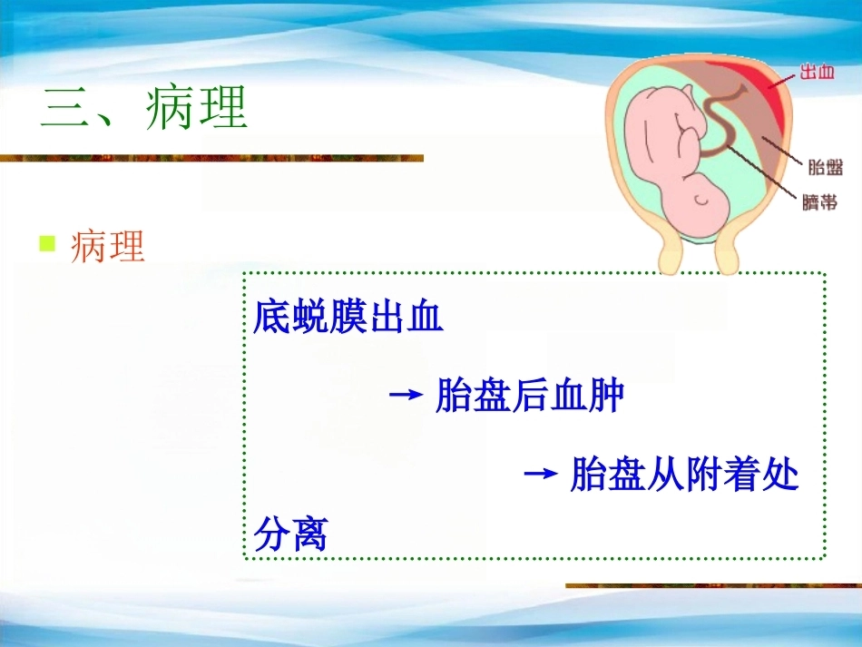 异常产褥妇产科学3_第7页