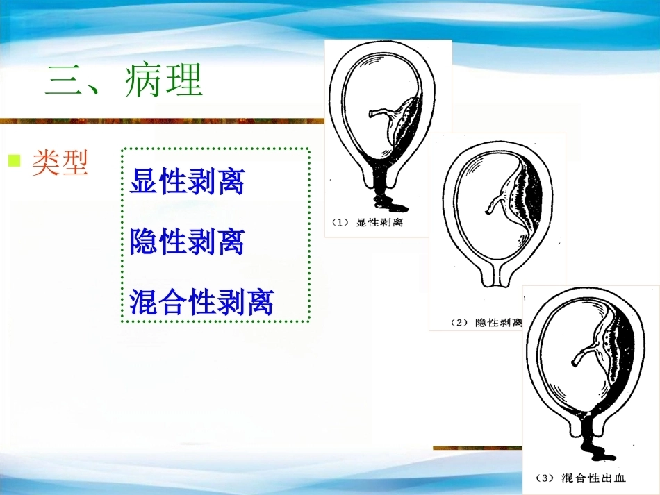 异常产褥妇产科学3_第8页