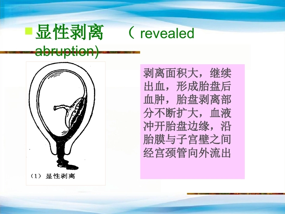 异常产褥妇产科学3_第9页