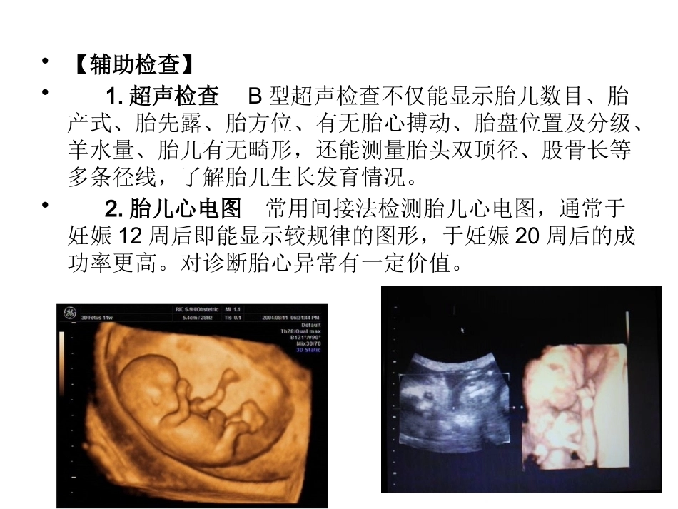 妊娠诊断4_第10页