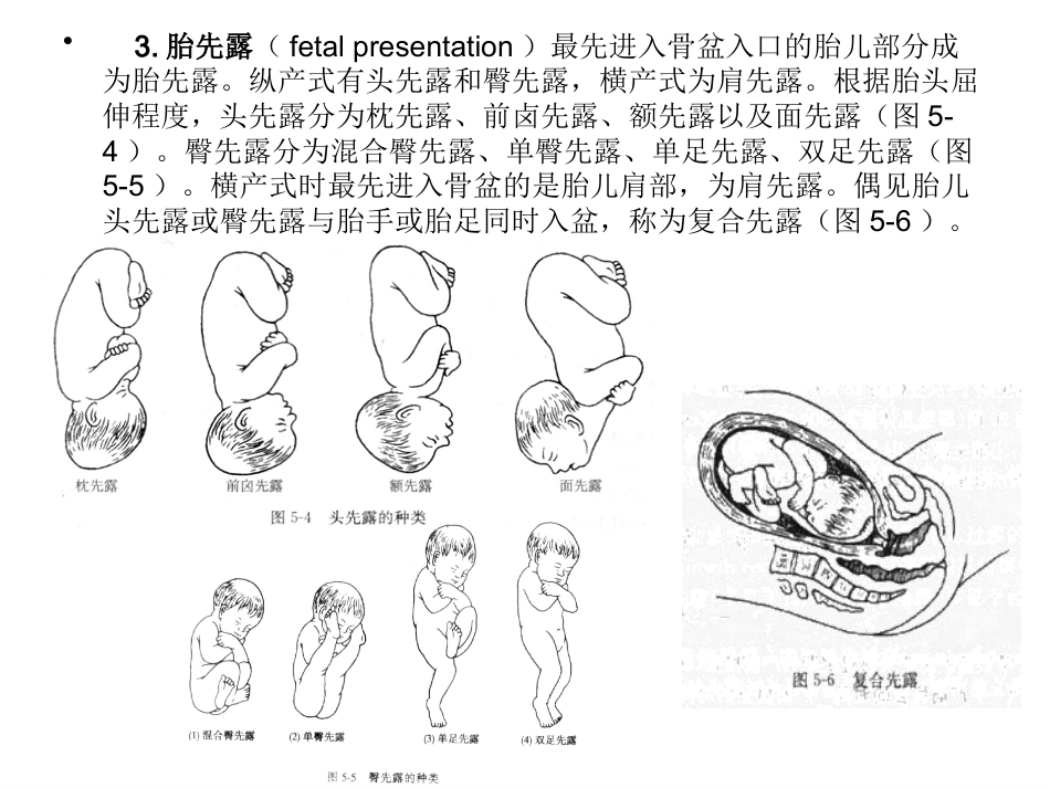 妊娠诊断4_第12页