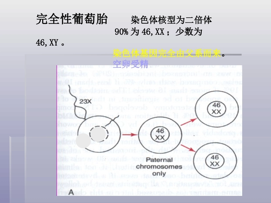 妊娠滋养细胞疾病4_第12页