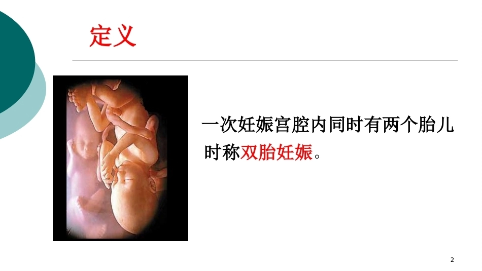 双胎妊娠ppt课件4_第2页