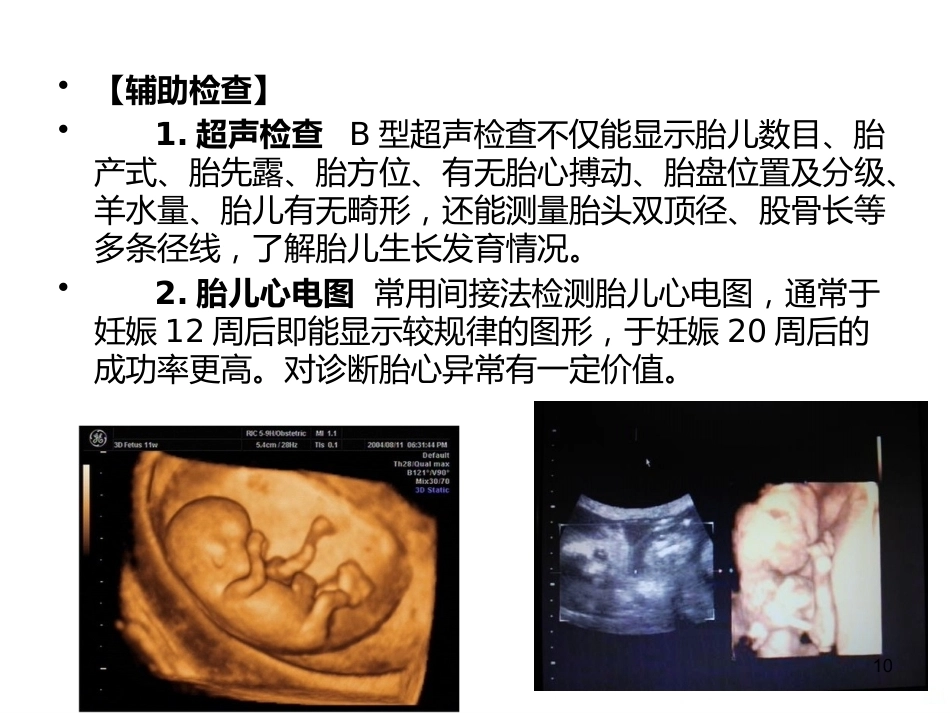 妊娠诊断PPT课件5_第10页