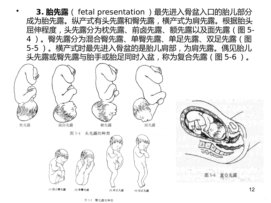 妊娠诊断PPT课件5_第12页