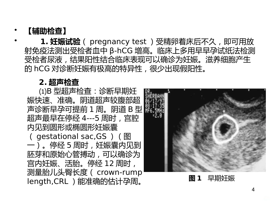 妊娠诊断PPT课件5_第4页