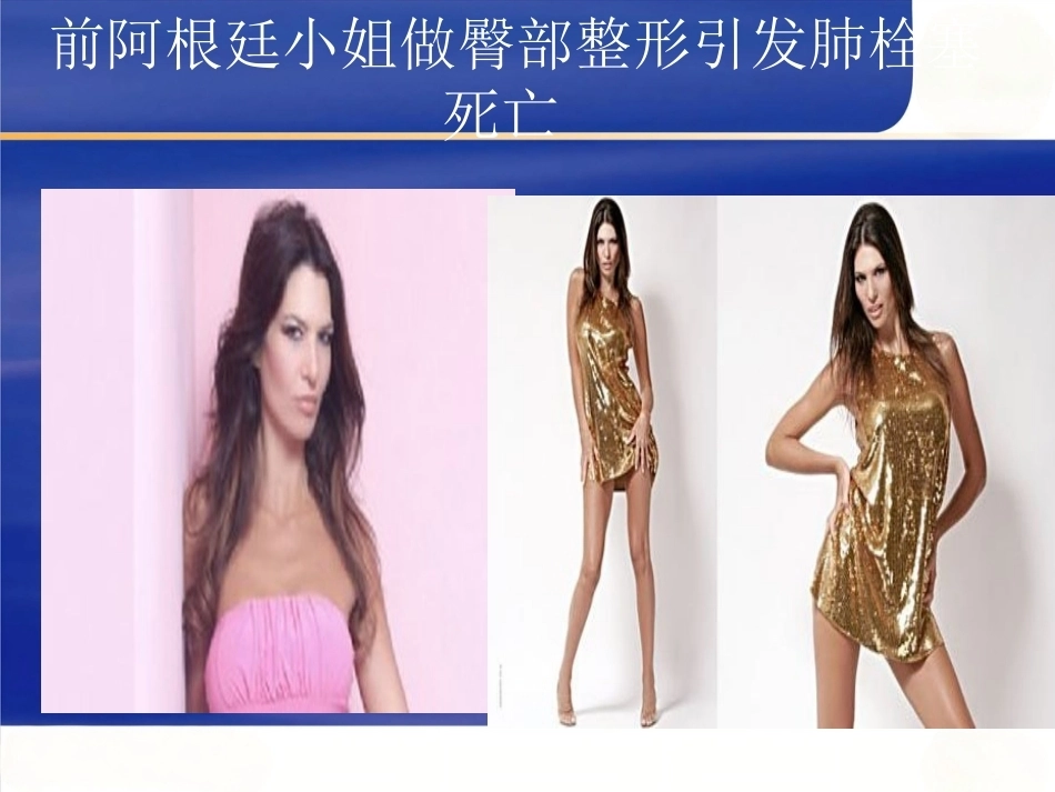围产期肺栓塞6_第2页