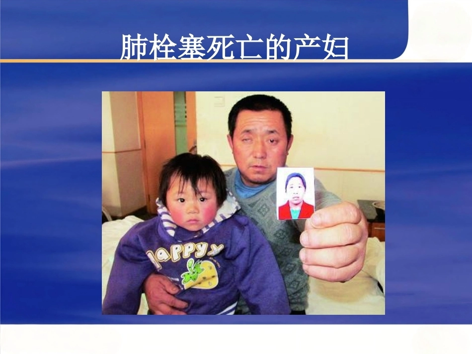 围产期肺栓塞6_第3页