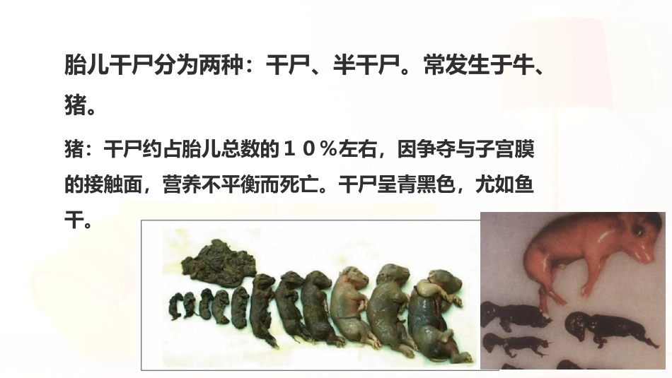 外产科6妊娠期疾病_第12页