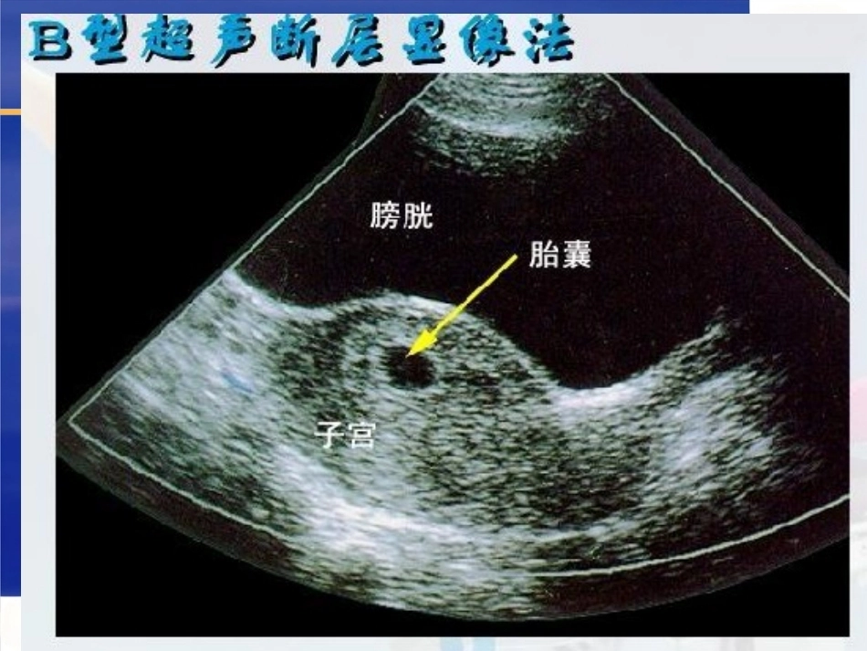 妊娠诊断6_第10页