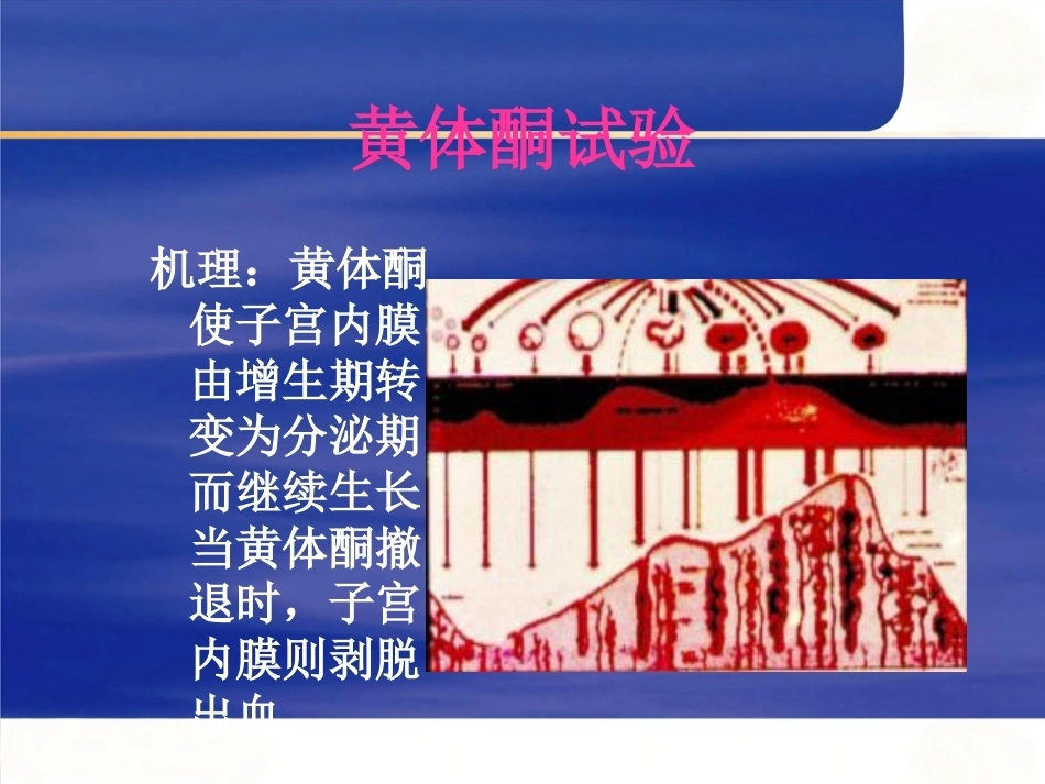 妊娠诊断6_第13页