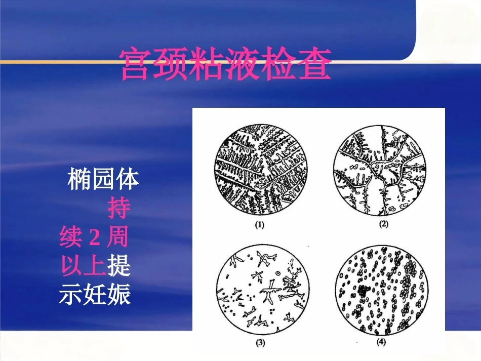 妊娠诊断6_第14页