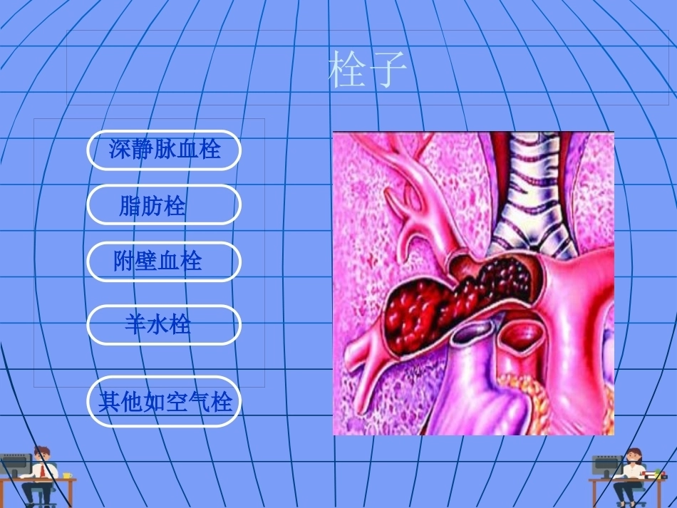 妊娠与肺栓塞6_第5页