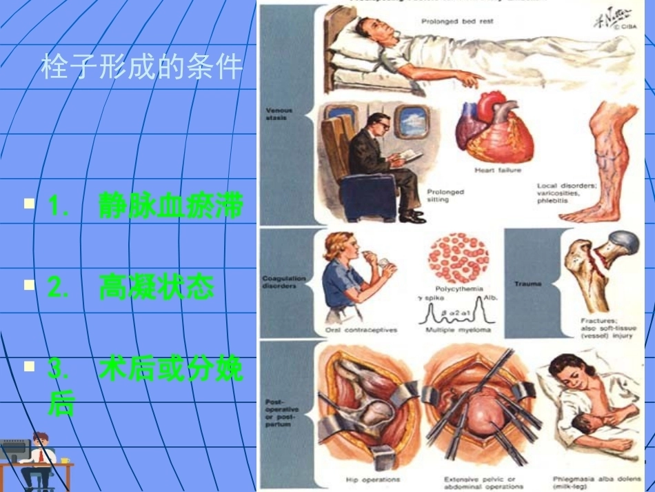 妊娠与肺栓塞6_第7页