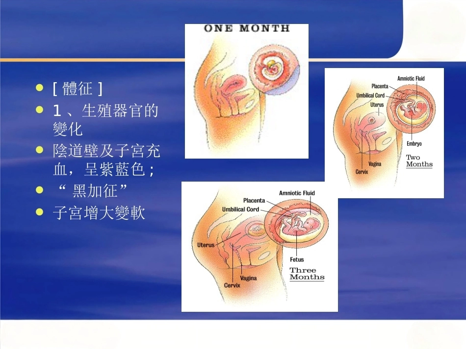 妊娠诊断PPT7_第4页