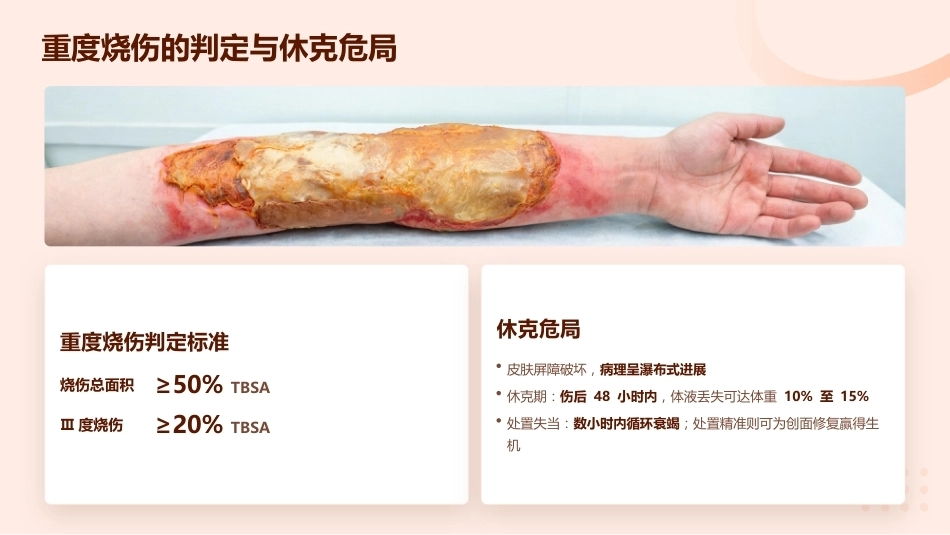 重度烧伤患者的液体复苏与感染防控_第4页