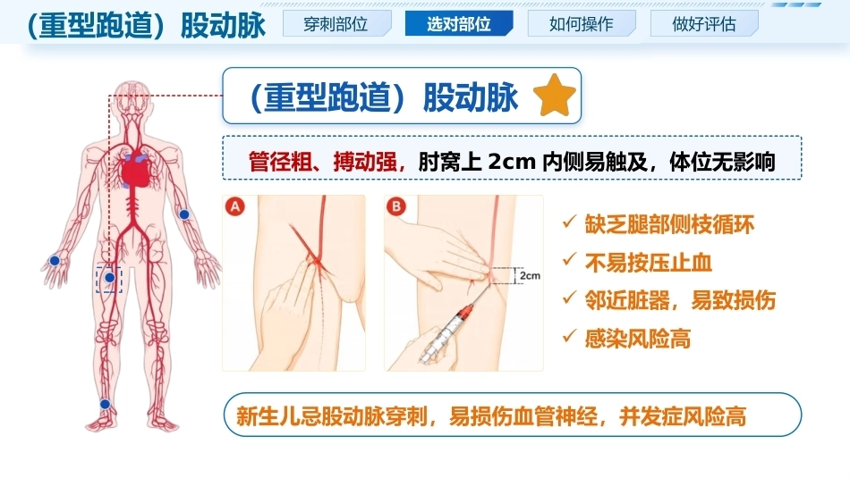 动脉采血实操要点_第8页