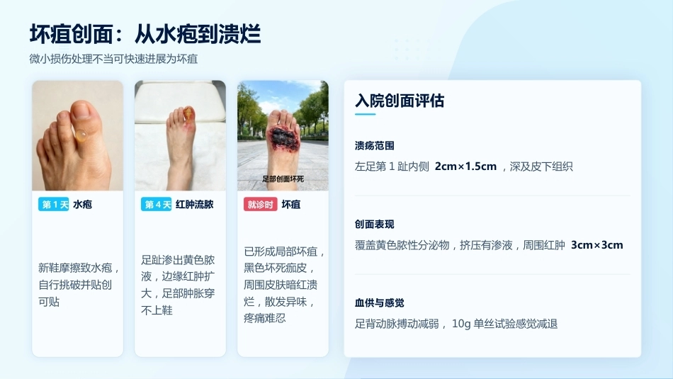 一例糖尿病足坏疽的清创与换药护理_第5页