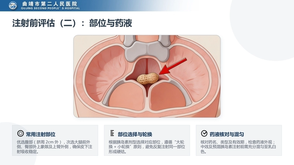 胰岛素皮下注射团体标准解读_第14页