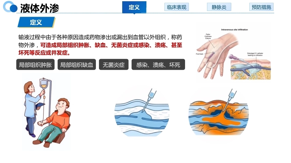 液体外渗的预防与处理_第3页