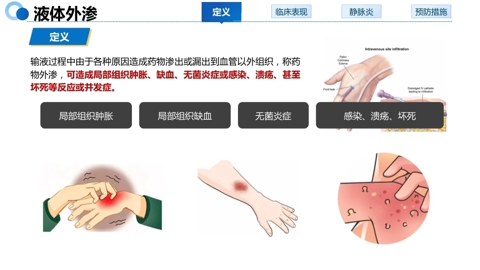 液体外渗的预防与处理_第4页