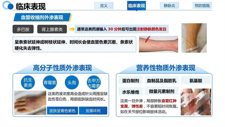 液体外渗的预防与处理_第7页