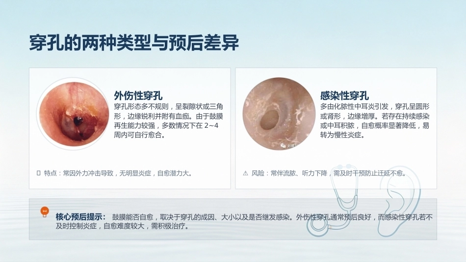 鼓膜穿孔护理全攻略_第6页
