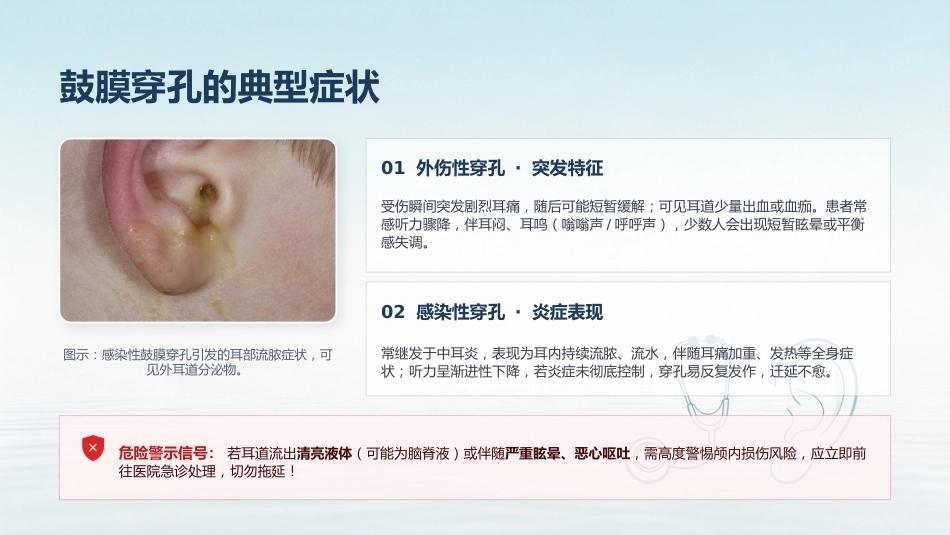 鼓膜穿孔护理全攻略_第8页