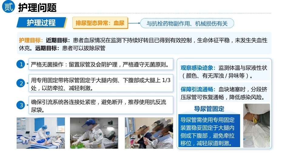 以问题为导向的1例脑梗死合并血尿患者的循证护理查房_第14页